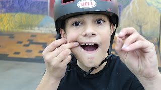 Crashed and Knocked My Tooth out!