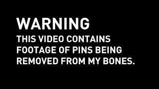 WARNING: This video contains gnarly content....