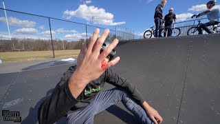 THE PRICE YOU PAY TO HOLD A BMX WORLD RECORD!