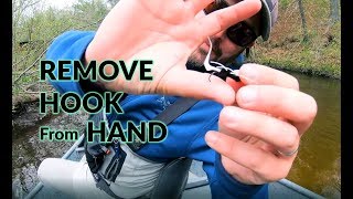 Buried Hook:  Push it Through or String Trick?
