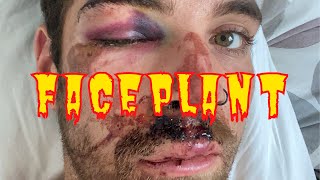 LIL MOINE - FACEPLANT