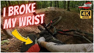 I broke my wrist  in Trailcenter Wien HWW |...