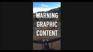 The Time I Got Knocked Out On My Bike #shorts