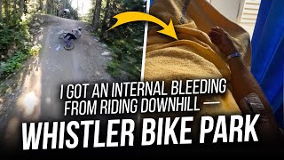 Heavy mtb DH crash gave me INTERNAL...