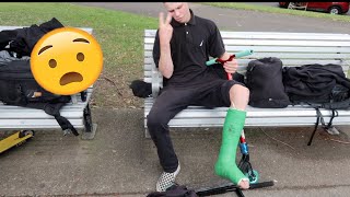 SCOOTERING WITH A BROKEN LEG !