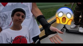 HE IS RIDING WITH A BROKEN WRIST !