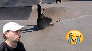 CANT BELIEVE HE BROKE HIS ANKLE..