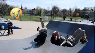 HE WONT BE SCOOTERING FOR A WHILE…