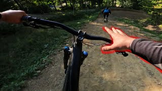 When riding without gloves goes horribly wrong...