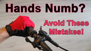 Cyclist's Palsy/Handlebar Palsy a.k.a. Ulnar...