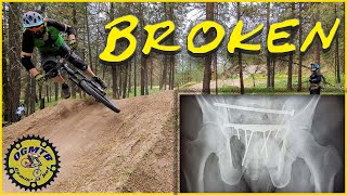 'How I Broke My Pelvis...On A MASSIVE Jump!'