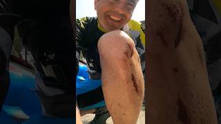 Heridas de guerra  #fail #mtb #shorts...