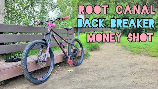 Root Canal, Back Breaker, Money $hot | Edmonton AB