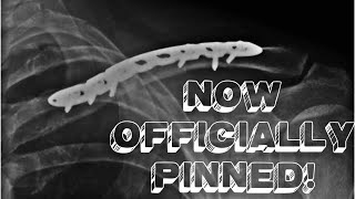 NOW OFFICIALLY PINNED! *Recovery Part 2*