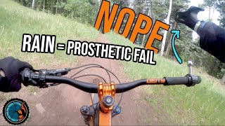 The Day My Prosthetic Failed - Mountain Biking...