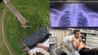 My Worst Crash Ever! - My Bike Put Me In The...
