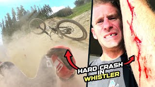 HARD CRASH ON MY DOWNHILL BIKE IN WHISTLER...