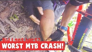 Worst Mountain Bike Crash - MTB VLOG 1.0