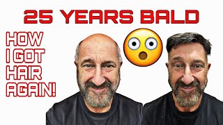CHEAPER THAN A HAIR TRANSPLANT *NO SURGERY*