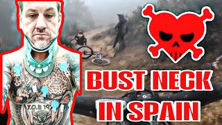 SONNY FRACTURED HIS NECK IN SPAIN!!
