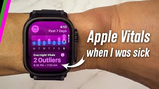 Did My Apple Watch Know I Was Sick Before I Did?