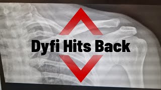 Dyfi Hits Back.. Broken.. battered and bruised.