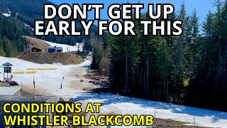 It Is Over For 1 Mountain. Whistler Blackcomb...