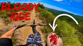 |Ep 66| Bloody Slide Out |