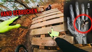 Hand gebrochen... Downhill Session geht schief!
