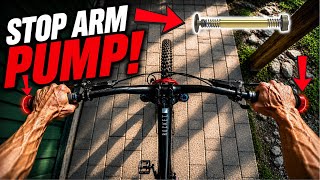 Goodbye Arm Pump…(The MTB Upgrades I Wish I...
