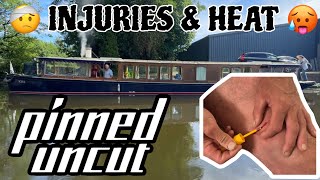 PINNED UNCUT *INJURIES-AN OPERATION-VERY HOT*