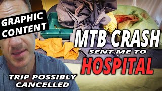 My Mountain Bike Put Me In Hospital..... Again...