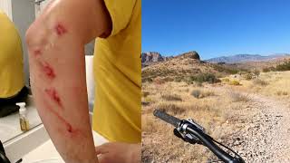 I Kinda Wrecked on my Mtn Bike (Badger Pass)...