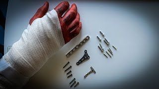18 Schrauben & 3 Platten ENDLICH raus!...