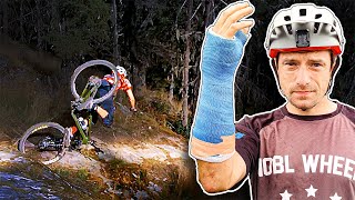 How I BROKE My Wrist By Missing One CRUCIAL...