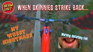 I BROKE MY TEETH! // JORDAN BOOSTMASTER //...