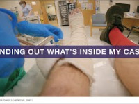 WHAT IS INSIDE MY CAST?! | The Brankle Diary 3...