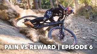 MTB INJURIES: The head | Pain vs Reward E6