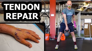 BACK IN THE GYM FOUR DAYS AFTER SURGERY (hand...