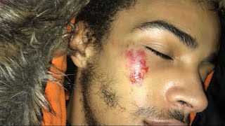 *Knocked Out* WHEN BIKELIFE GOES WRONG!!