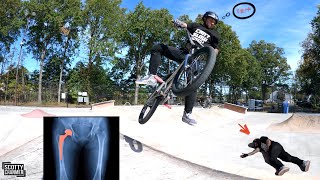 The Kid Just Can't Get A Break! |360 Whip Hip...