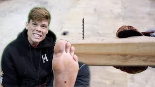 BIG BOY STEPPED ON A SCREW!