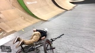 MATTY BROKE HIS LEG!