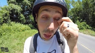 BUG IN THE EYE ON 20 MILE RIDE!