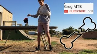 500 Subscribers! + Injury