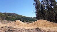11 Year old,...  big  gap