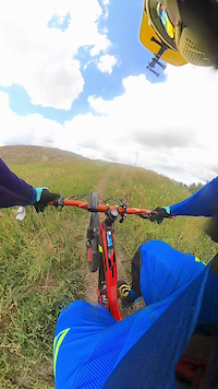 Sherwood Park Trails and Dirt Jumps