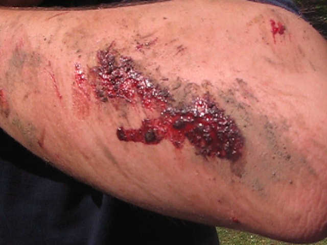Must Watch Video