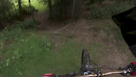 Bike to the face - Broken Collarbone